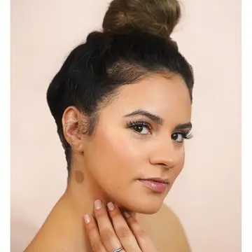 A woman with her hair in a bun looks at the camera, showing a large, round birthmark on her neck near a discreet B12 Vitamin Patch - Instant Energy by Sonia's Vokalized Kreations (64 Patches), a popular transdermal supplement.